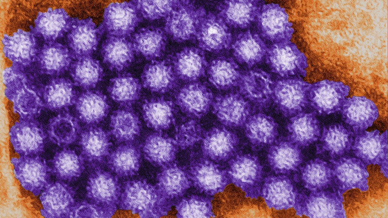This transmission electron micrograph (TEM) from the U.S-based Centers for Disease Control shows norovirus virions, or virus particles. (Provided/CDC)