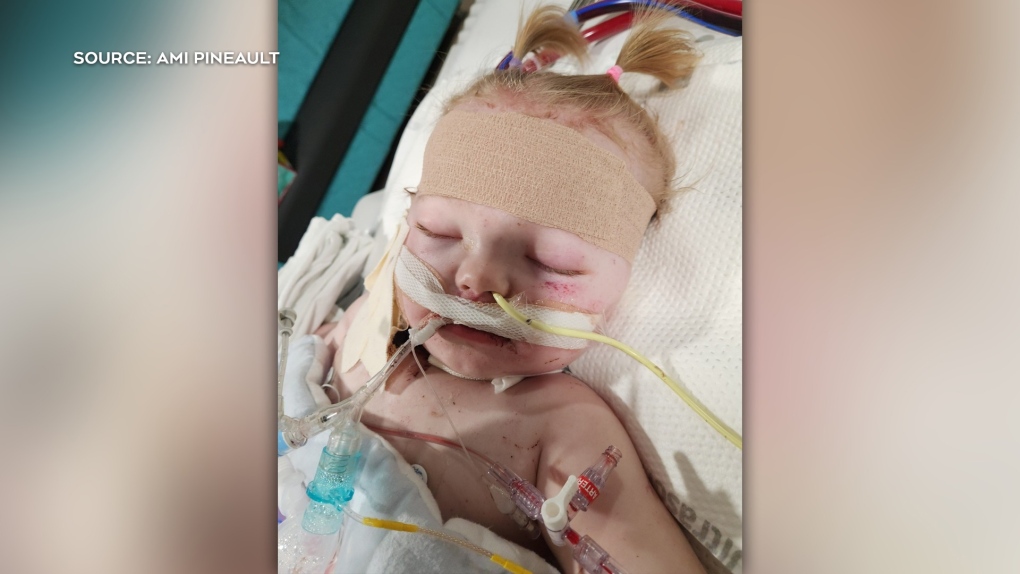 Calgary toddler hospitalized in Edmonton